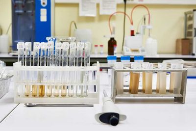 Is Labcorp Holdings Stock Underperforming the Nasdaq?